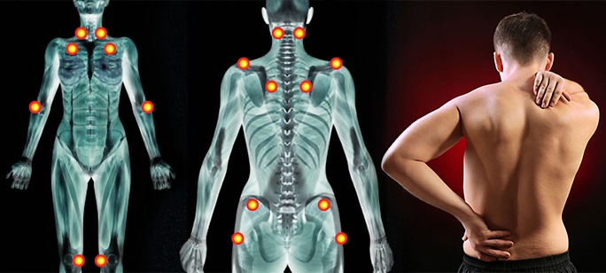 Top 7 Back Pain Myths