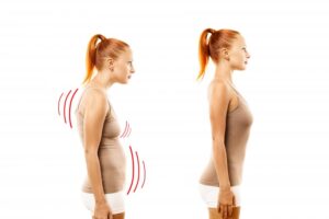comparison photos of bad posture and good posture